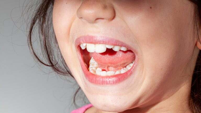 misaligned teeth specialists in hong kong